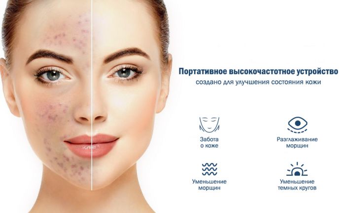 Портативна Дарсонваль Medica+ Darsoline 7.0 (MD-102969)